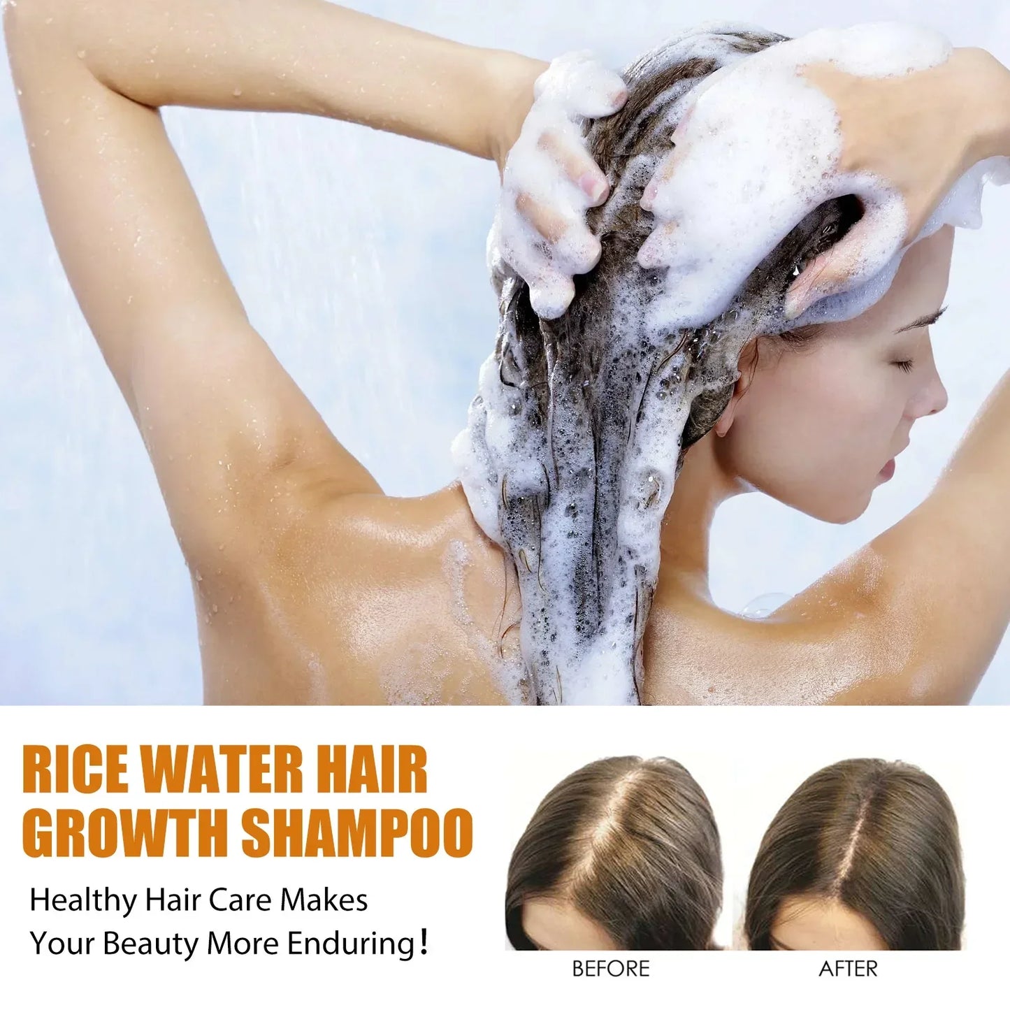 Rice Water Hair Growth Shampoo Deep Clean Anti Hair Loss Moisturize Hair Root Champoing Pour Cheveux Shampooings Anti Balding