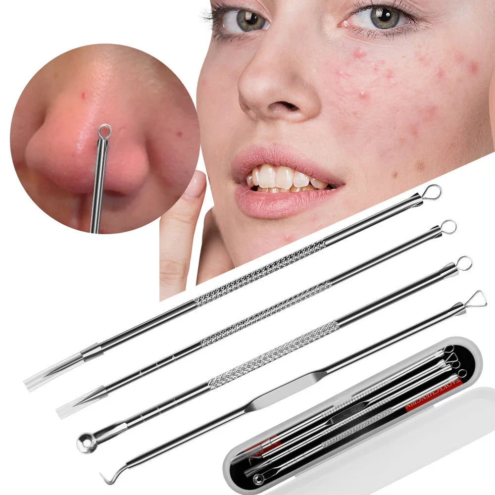 4Pcs Blackhead Acne Remover Set Beauty Skin Care Pore Cleaner Acne Needle Pimple Stainless Steel Pimple Needles Removal Tools