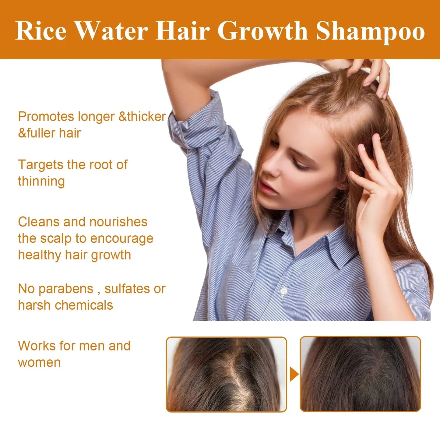 Rice Water Hair Growth Shampoo Deep Clean Anti Hair Loss Moisturize Hair Root Champoing Pour Cheveux Shampooings Anti Balding